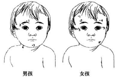 脸上的痣与财运有什么关系？